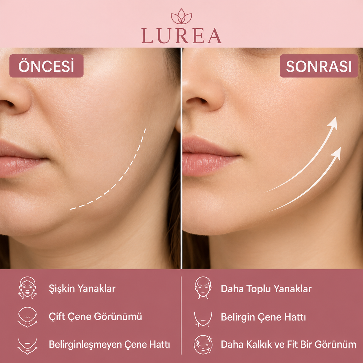 Lurea™ LymphLift: Yüz Şekillendirici ve Ödem Atıcı Masaj Fırçası